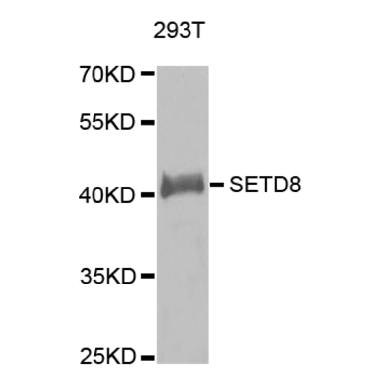 Western blot - SETD8 antibody from Signalway Antibody (38636) - Antibodies.com