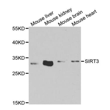 Western blot - SIRT3 antibody from Signalway Antibody (38652) - Antibodies.com