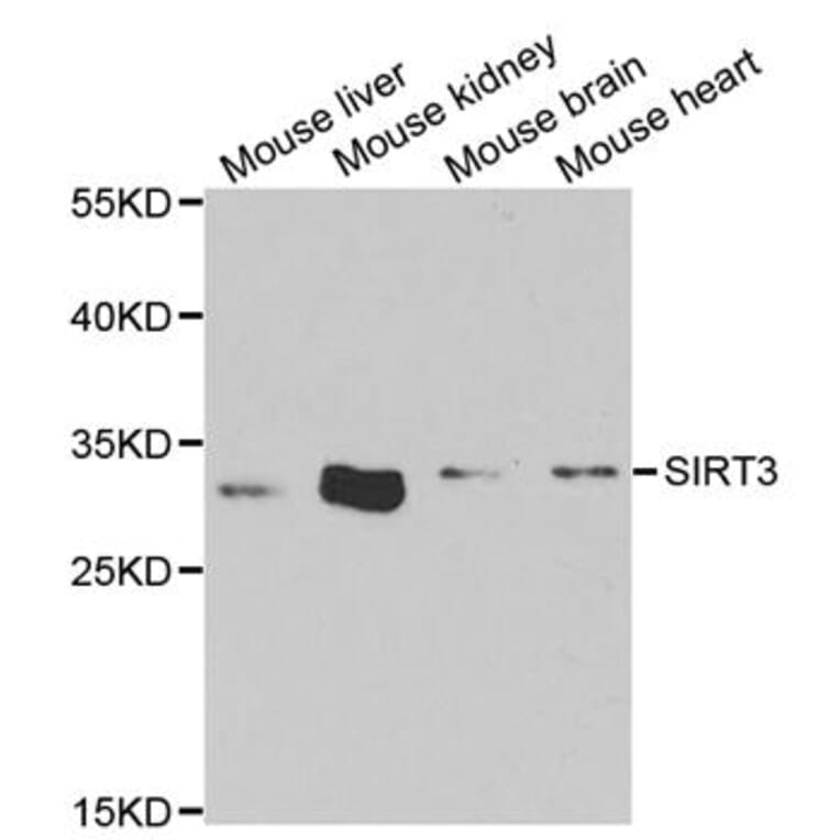 Western blot - SIRT3 antibody from Signalway Antibody (38652) - Antibodies.com