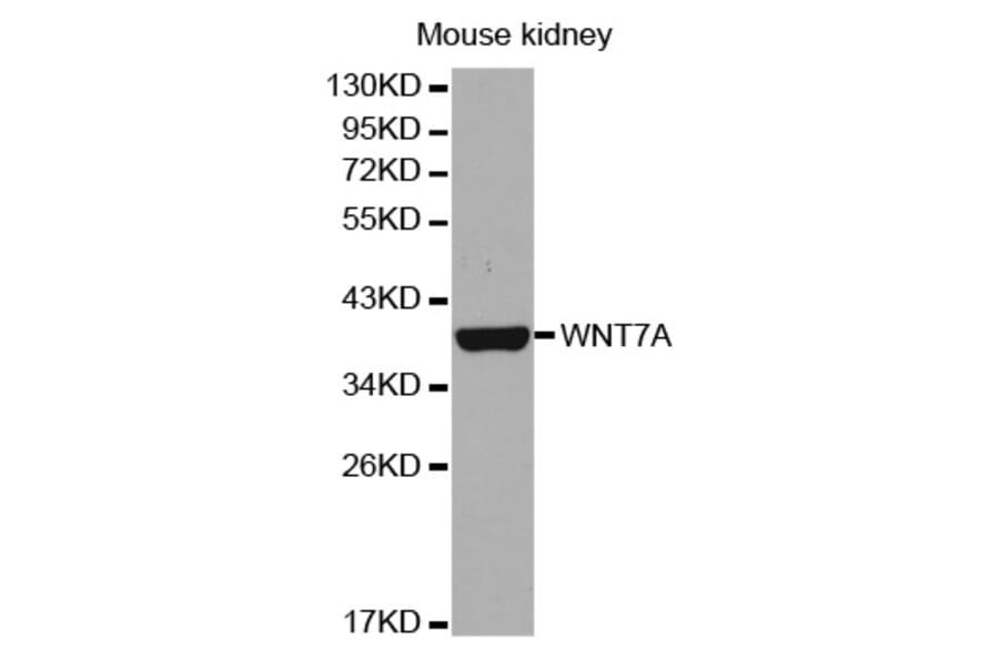 Western blot - WNT7A antibody from Signalway Antibody (38653) - Antibodies.com