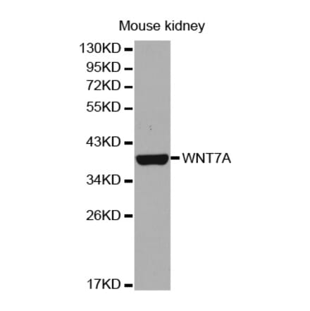 Western blot - WNT7A antibody from Signalway Antibody (38653) - Antibodies.com