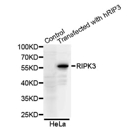 Western blot - RIPK3 antibody from Signalway Antibody (38654) - Antibodies.com