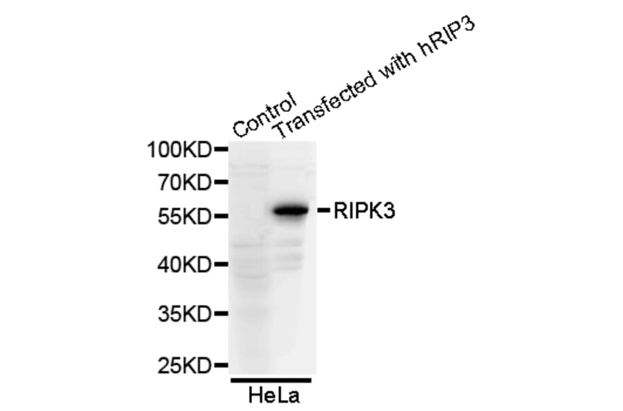 Western blot - RIPK3 antibody from Signalway Antibody (38654) - Antibodies.com
