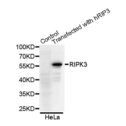 Western blot - RIPK3 antibody from Signalway Antibody (38654) - Antibodies.com