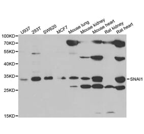 Western blot - Snail antibody from Signalway Antibody (38667) - Antibodies.com