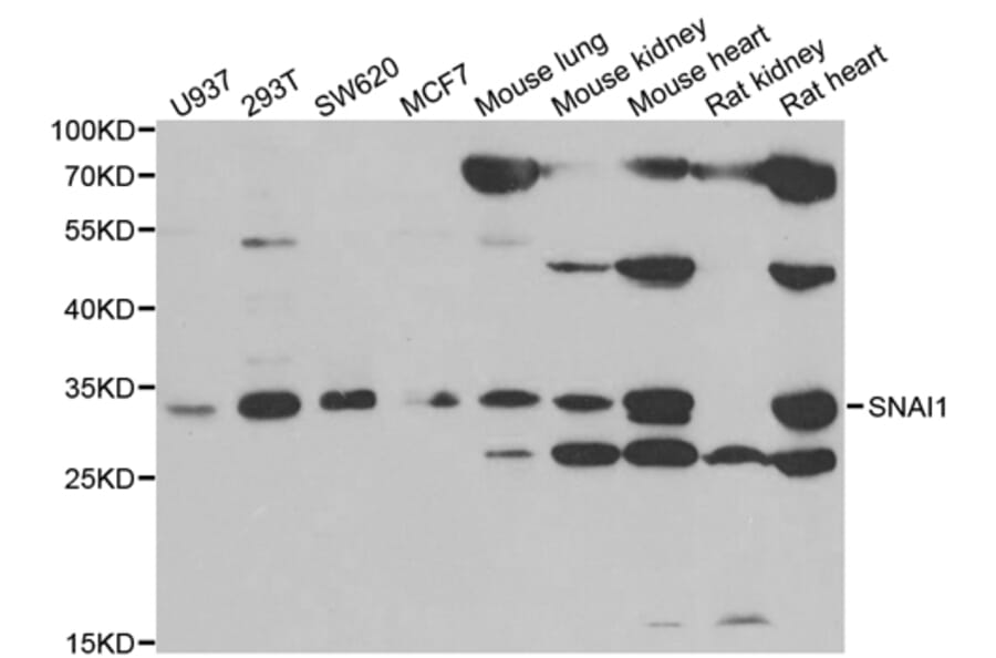 Western blot - Snail antibody from Signalway Antibody (38667) - Antibodies.com