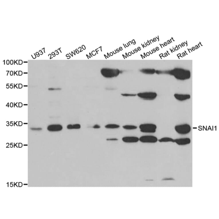 Western blot - Snail antibody from Signalway Antibody (38667) - Antibodies.com