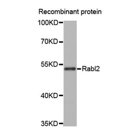 Western blot - Rabl2 antibody from Signalway Antibody (38671) - Antibodies.com