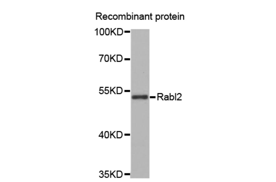 Western blot - Rabl2 antibody from Signalway Antibody (38671) - Antibodies.com