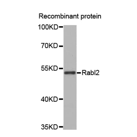 Western blot - Rabl2 antibody from Signalway Antibody (38671) - Antibodies.com