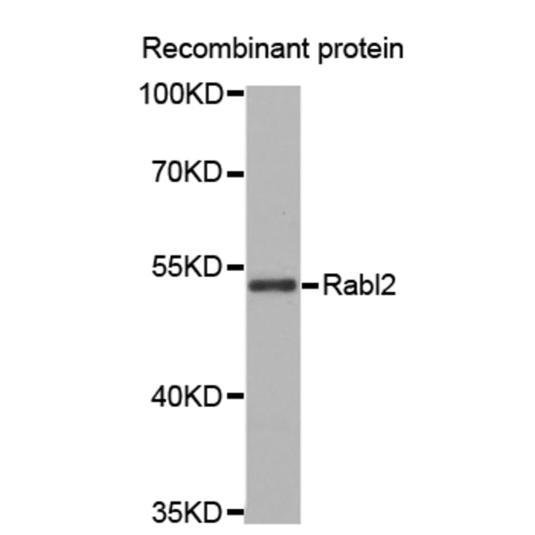 Western blot - Rabl2 antibody from Signalway Antibody (38671) - Antibodies.com