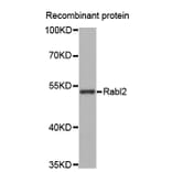Western blot - Rabl2 antibody from Signalway Antibody (38671) - Antibodies.com