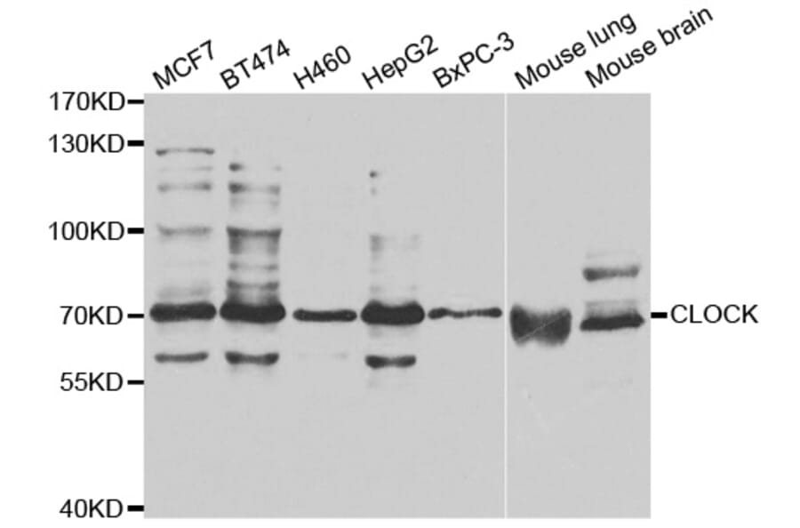 Western blot - CLOCK antibody from Signalway Antibody (38677) - Antibodies.com