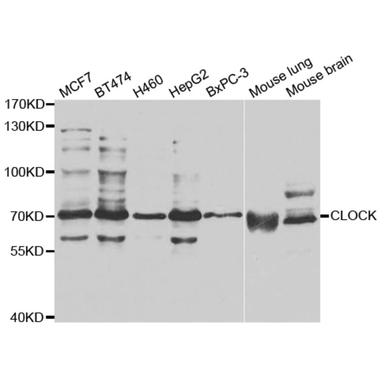 Western blot - CLOCK antibody from Signalway Antibody (38677) - Antibodies.com