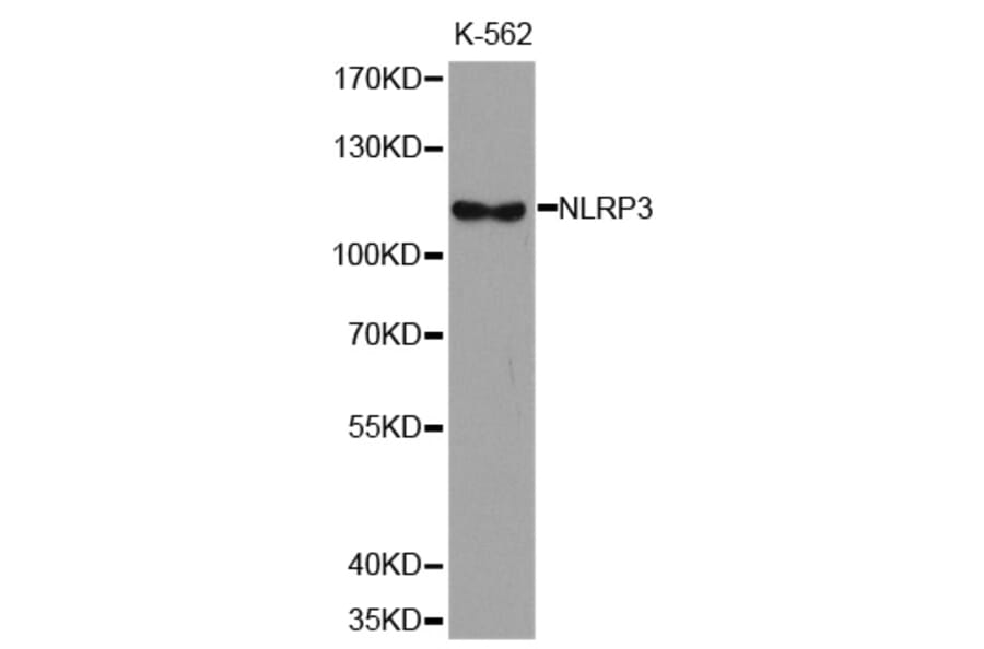 Western blot - NLRP3 antibody from Signalway Antibody (38679) - Antibodies.com