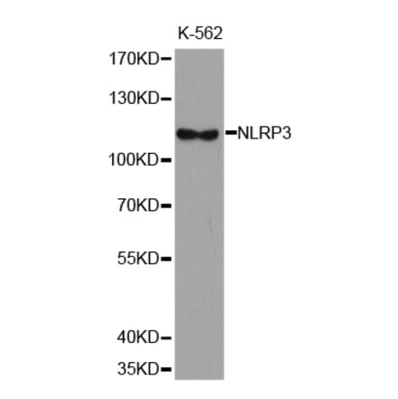 Western blot - NLRP3 antibody from Signalway Antibody (38679) - Antibodies.com