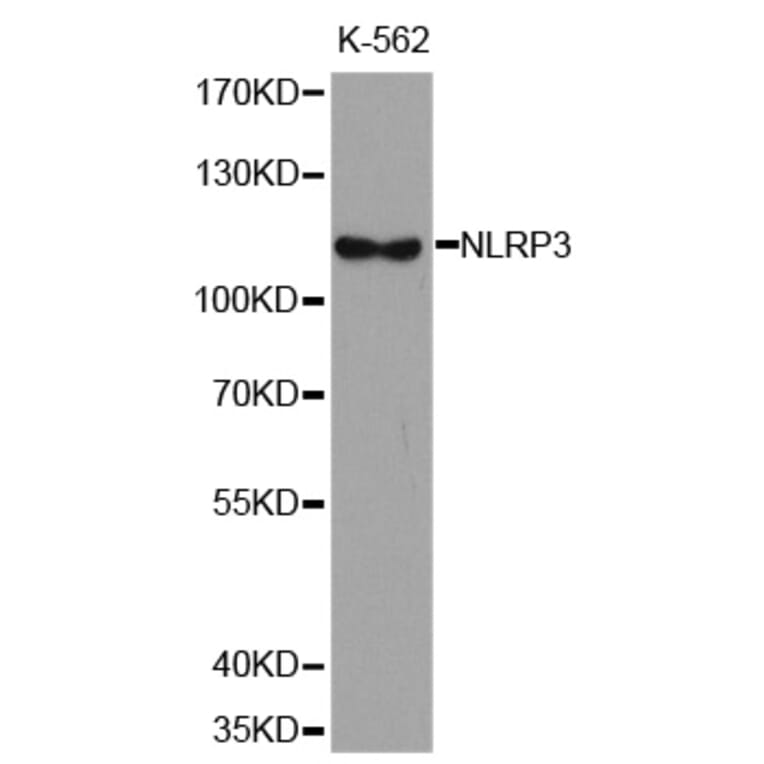 Western blot - NLRP3 antibody from Signalway Antibody (38679) - Antibodies.com