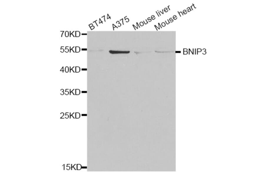 Western blot - BNIP3 antibody from Signalway Antibody (38681) - Antibodies.com