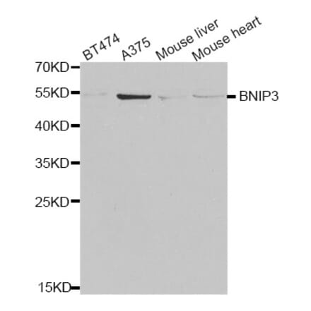 Western blot - BNIP3 antibody from Signalway Antibody (38681) - Antibodies.com