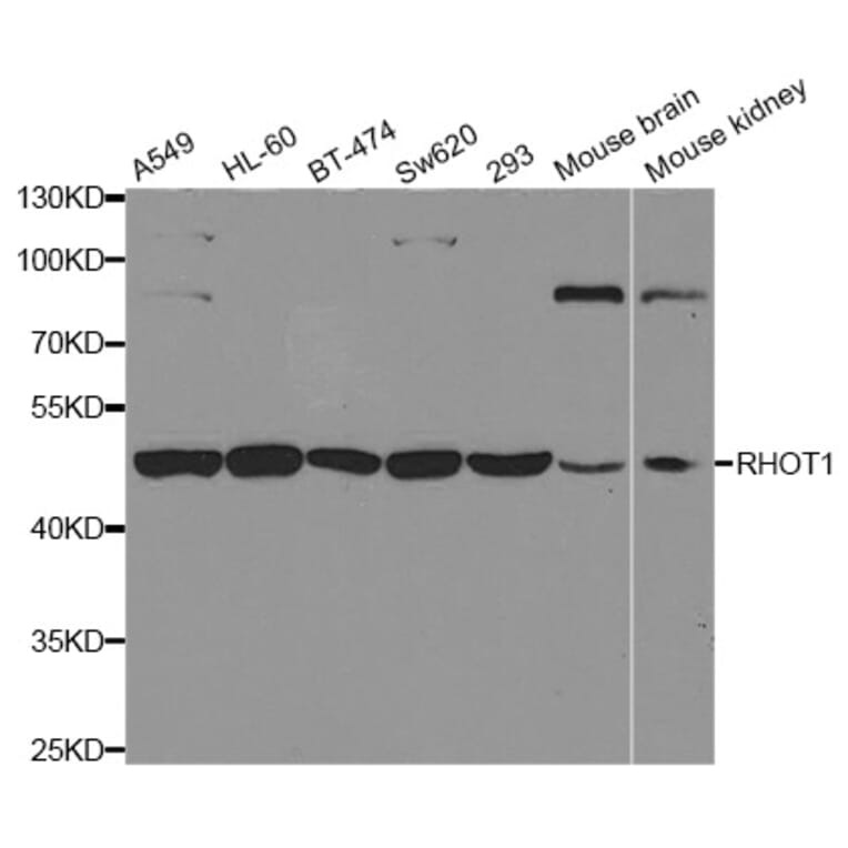Western blot - RHOT1 antibody from Signalway Antibody (38697) - Antibodies.com
