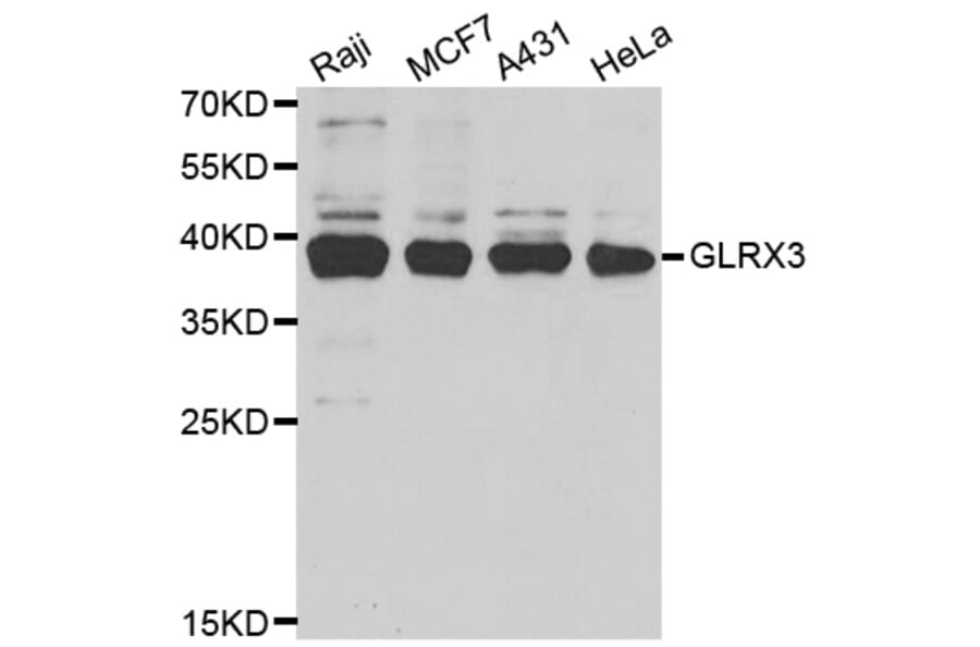 Western blot - GLRX3 antibody from Signalway Antibody (38713) - Antibodies.com