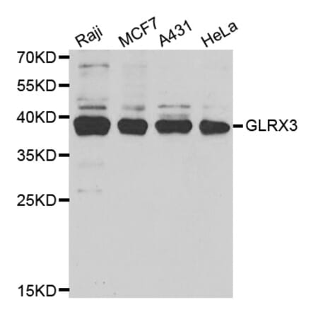 Western blot - GLRX3 antibody from Signalway Antibody (38713) - Antibodies.com