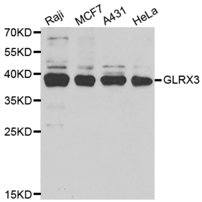 Western blot - GLRX3 antibody from Signalway Antibody (38713) - Antibodies.com
