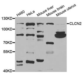 Western blot - CLCN2 antibody from Signalway Antibody (38718) - Antibodies.com
