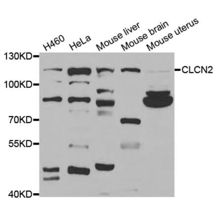 Western blot - CLCN2 antibody from Signalway Antibody (38718) - Antibodies.com