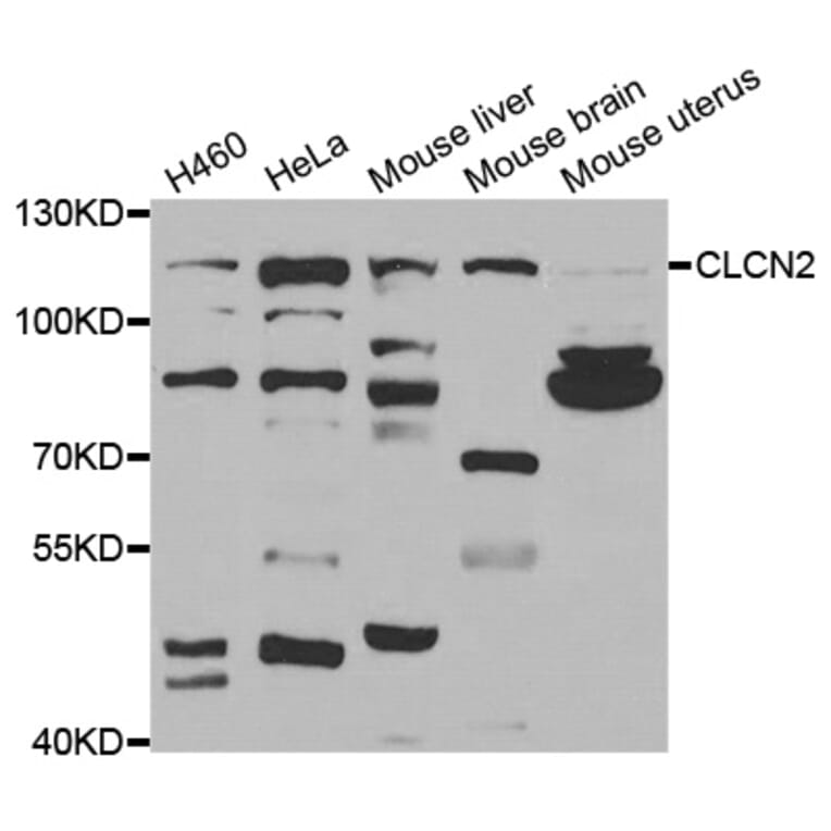 Western blot - CLCN2 antibody from Signalway Antibody (38718) - Antibodies.com