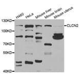 Western blot - CLCN2 antibody from Signalway Antibody (38718) - Antibodies.com