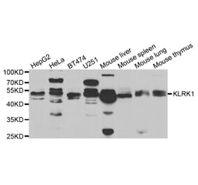 Western blot - KLRK1 antibody from Signalway Antibody (38721) - Antibodies.com