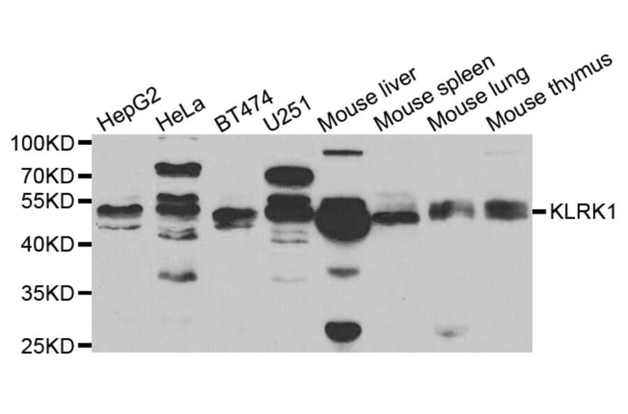 Western blot - KLRK1 antibody from Signalway Antibody (38721) - Antibodies.com