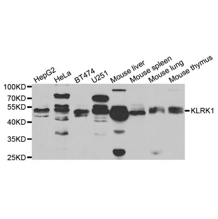 Western blot - KLRK1 antibody from Signalway Antibody (38721) - Antibodies.com