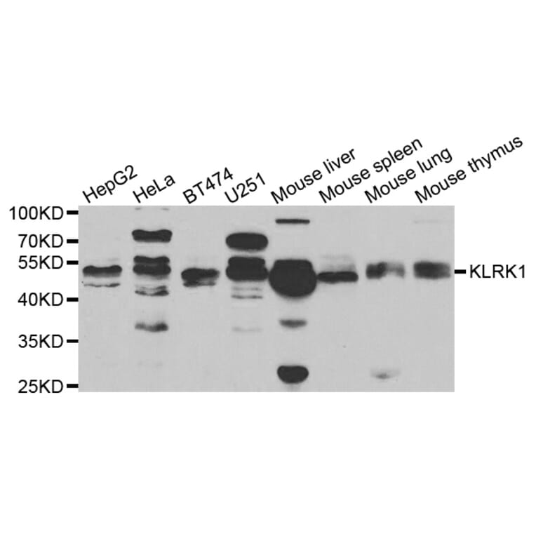 Western blot - KLRK1 antibody from Signalway Antibody (38721) - Antibodies.com
