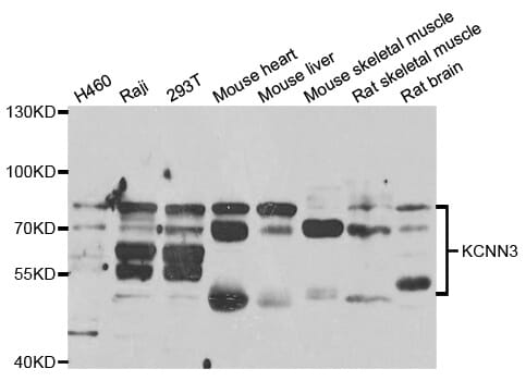 Western blot analysis of extracts of various cell lines, using KCNN3 antibody.