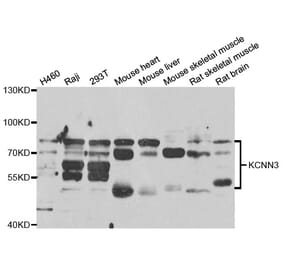 Western blot - KCNN3 antibody from Signalway Antibody (38722) - Antibodies.com