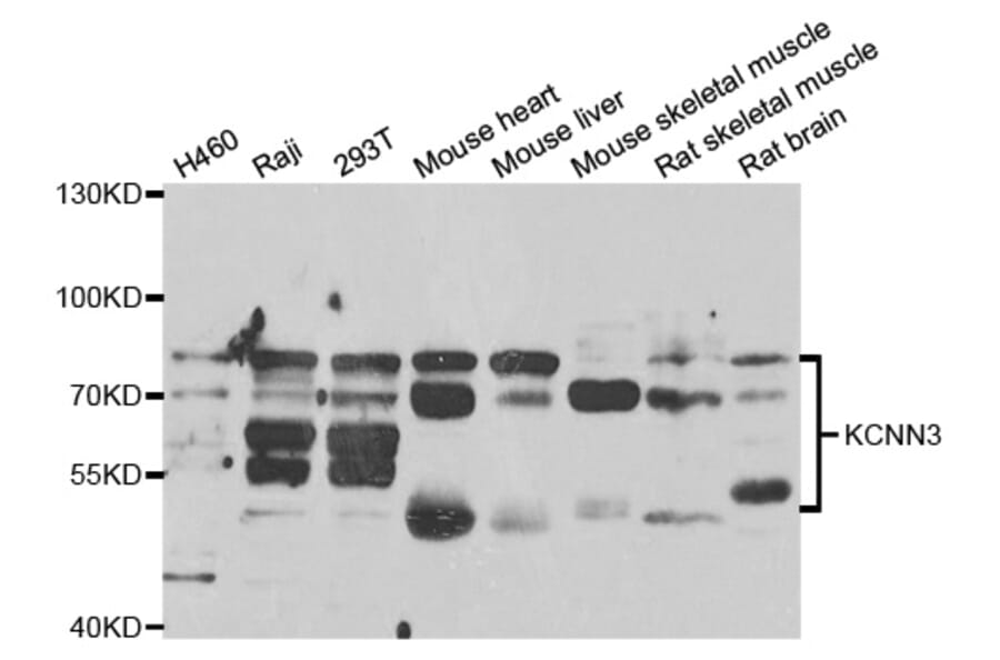 Western blot - KCNN3 antibody from Signalway Antibody (38722) - Antibodies.com