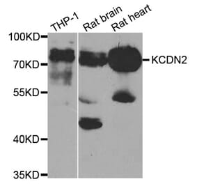 Western blot - KCND2 antibody from Signalway Antibody (38747) - Antibodies.com