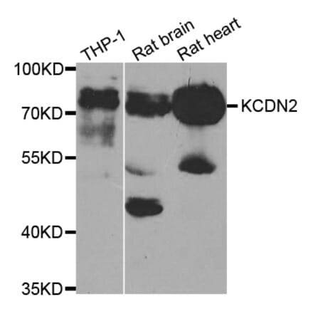 Western blot - KCND2 antibody from Signalway Antibody (38747) - Antibodies.com