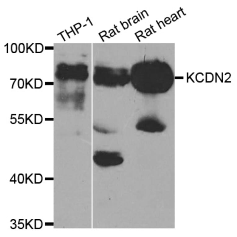 Western blot - KCND2 antibody from Signalway Antibody (38747) - Antibodies.com