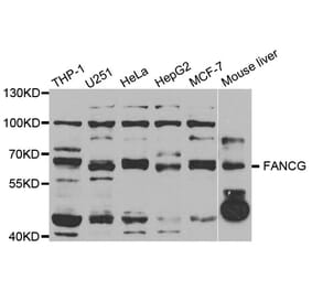 Western blot - FANCG antibody from Signalway Antibody (38748) - Antibodies.com