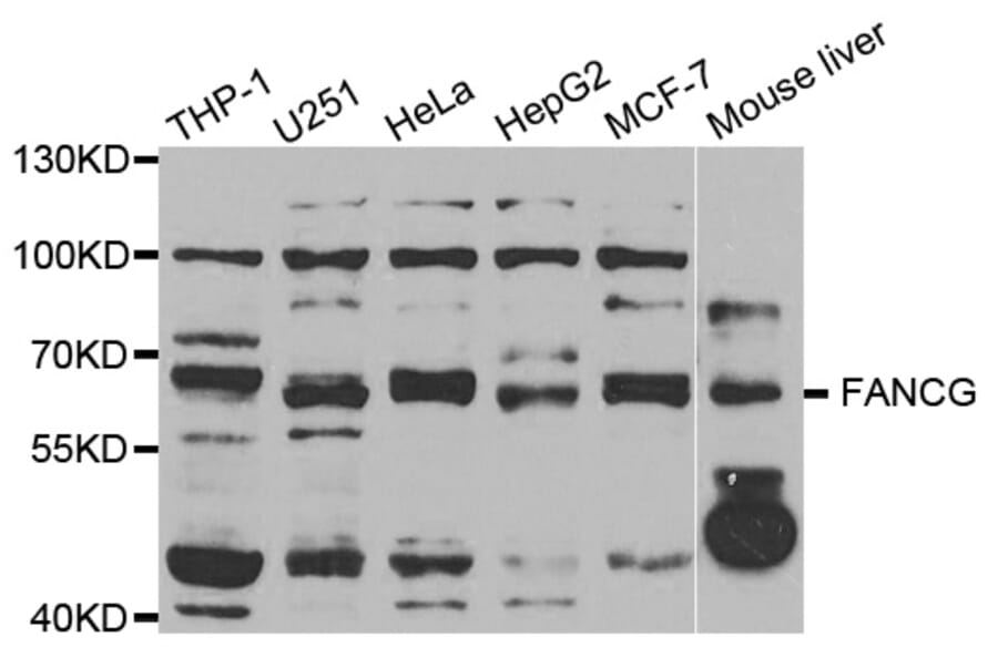 Western blot - FANCG antibody from Signalway Antibody (38748) - Antibodies.com