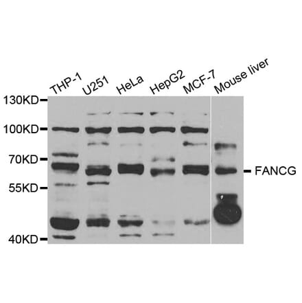 Western blot - FANCG antibody from Signalway Antibody (38748) - Antibodies.com