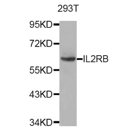 Western blot - IL2RB antibody from Signalway Antibody (38749) - Antibodies.com
