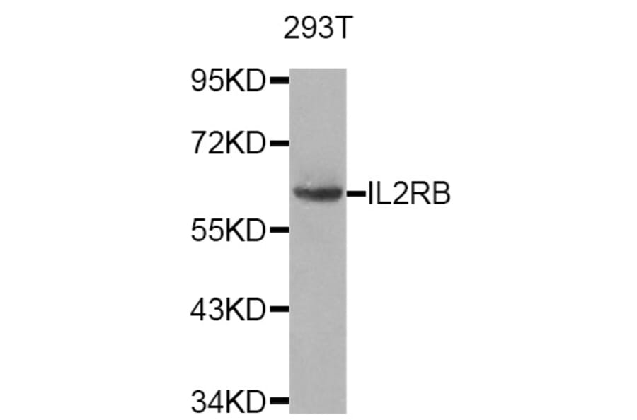 Western blot - IL2RB antibody from Signalway Antibody (38749) - Antibodies.com