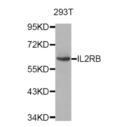 Western blot - IL2RB antibody from Signalway Antibody (38749) - Antibodies.com