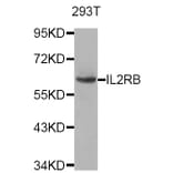 Western blot - IL2RB antibody from Signalway Antibody (38749) - Antibodies.com