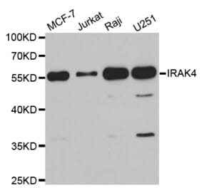 Western blot - IRAK4 antibody from Signalway Antibody (38750) - Antibodies.com