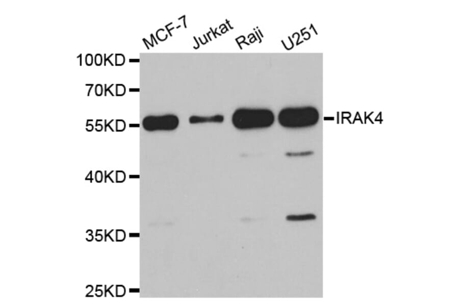 Western blot - IRAK4 antibody from Signalway Antibody (38750) - Antibodies.com